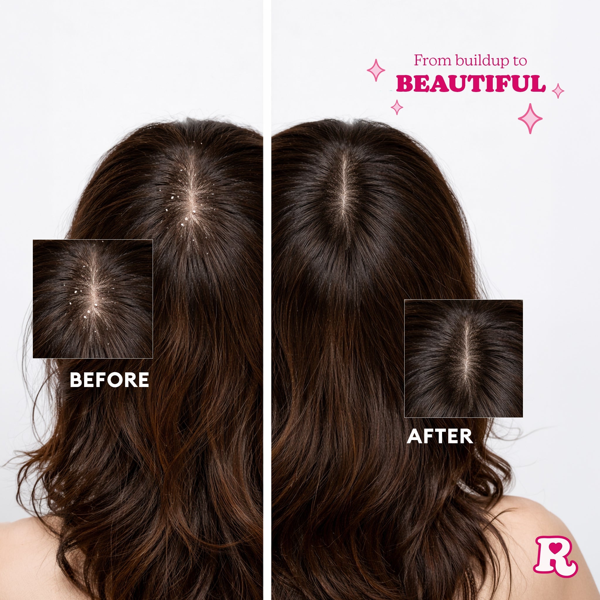 Redo Haircare Scratch That Scalp Brush